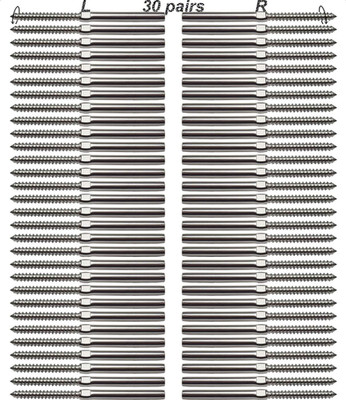 3/16 T316 Stainless Steel Cable Railing Hardware, System Kit, for Wood Posts, Sw