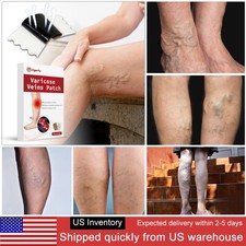 Varicose Veins Relief Patch  Spider Veins Heavy Legs Support  Natural Circulat