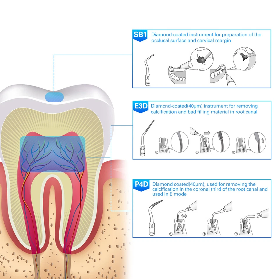 10X Dental Ultrasonic Piezo Scaler Tips fit Woodpecker EMS/DTE SATELEC Handpiece - Image 2 of 4