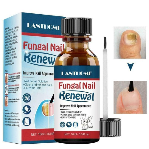 Nail Repair Anti Fungal Nail Infection Onychomycosis Paronychia Treatment Q1A5 - Picture 7 of 12