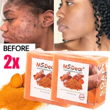 2PCS Natural Turmeric Soap Bar for Skin Whitening, Dark Spots & Brightening