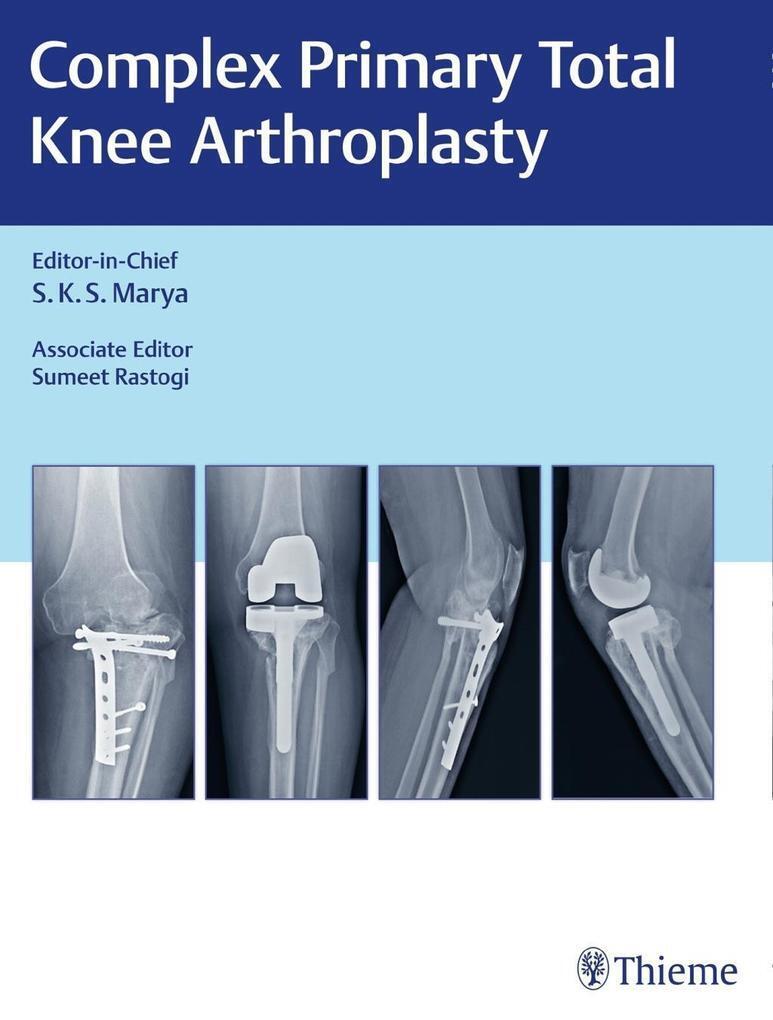Thumbnail - Complex Primary Total Knee Arthroplasty | Sumeet Rastogi | 2019