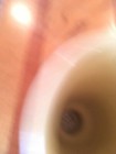 Picture 7 of 11