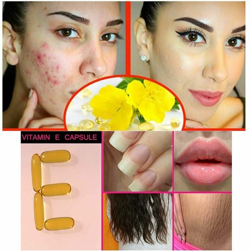 Evion 400 mg 50 Capsule BEST Vitamin E For Face Hair Acne Nails - Free Shipping - Picture 5 of 12