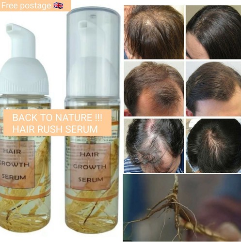 Grow Natural Gorgeous Hair Growth Density Serum Intense Hair Density in Weeks - Picture 4 of 12