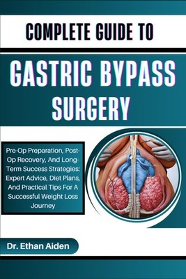 COMPLETE GUIDE TO GASTRIC BYPASS SURGERY: Pre-Op Preparation, Post-Op Recove...