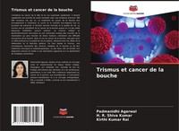 Trismus Et Cancer De La Bouche Kirthi Kumar Rai