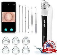 Maquina Para Quitar Puntos Negros Quita Nariz Sacar Saca Aspiradora Remueve NEW.