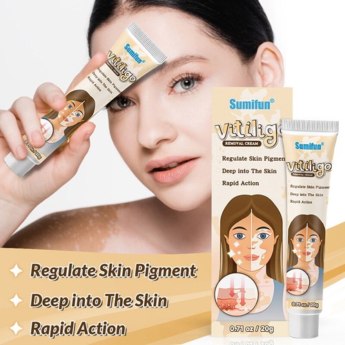 Treatment Moisturizing Cream White Spot Disease Vitiligo Balm Repair Ointment - Picture 2 of 8