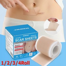 1.5M-15M Medical Grade Scar Removal Tape Silicone Scar Sheets Treatment Patches