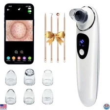 2025 Pore Vacuum with Camera - USB Rechargeable Blackhead Remover, 3 Levels, 6