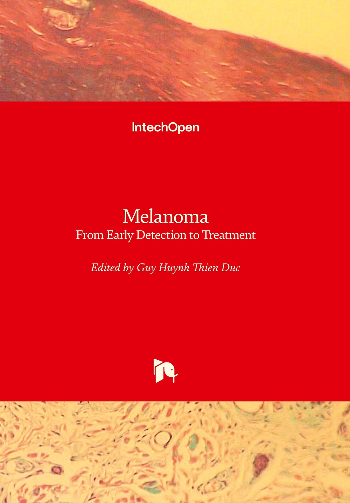 Thumbnail - Guy Huynh Thien Duc | Melanoma | Buch | Englisch (2013) | 732 S. |