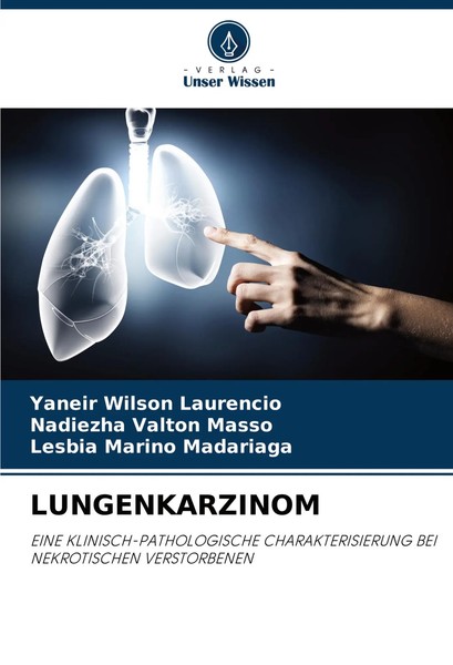Lungenkarzinom Yaneir Wilson Laurencio (U. A.) Taschenbuch 76 S. Deutsch 2025-image
