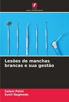 LesõEs De Manchas Brancas E Sua GestãO Saloni Patni