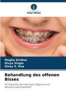 Behandlung Des Offenen Bisses Megha Girdhar (U. A.) Taschenbuch 156 S. Deutsch