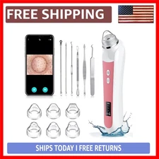 Luxury Light Pink Blackhead Remover Vacuum with HD Camera - Effortless Pore C...