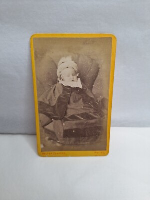 Viktorianisches Foto CDV Baby Walter Clayton Leicester Nottingham 