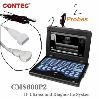 CONTEC CMS600P2 VET B ULTRASOUND DIAGNOSTIC SYSTEM SCANNER W/LINEAR PROBE
