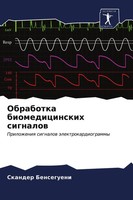 Skander Bensegueni | Obrabotka Biomedicinskih Signalow | Taschenbuch | Russisch