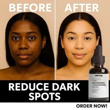 Collagen Serum Anti-Aging Wrinkle Treatment 1 fl oz