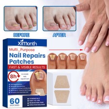 60Pc Nail Repair Patches Treatment Toenail Fungus Treatment Sticker Toenail Care