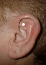 Less Stress Acupressure Magnets Two Personal Kits New Plastic Bag 2025 Success