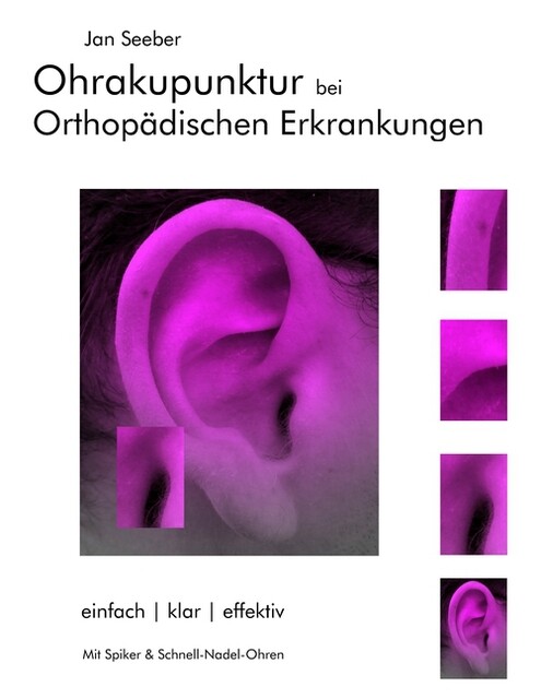 Thumbnail - Ohrakupunktur Bei Orthopädischen Erkrankungen Jan Seeber