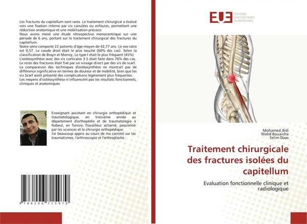 Mohamed Jlidi (U. A.) | Traitement Chirurgicale Des Fractures IsoléEs Du...-image