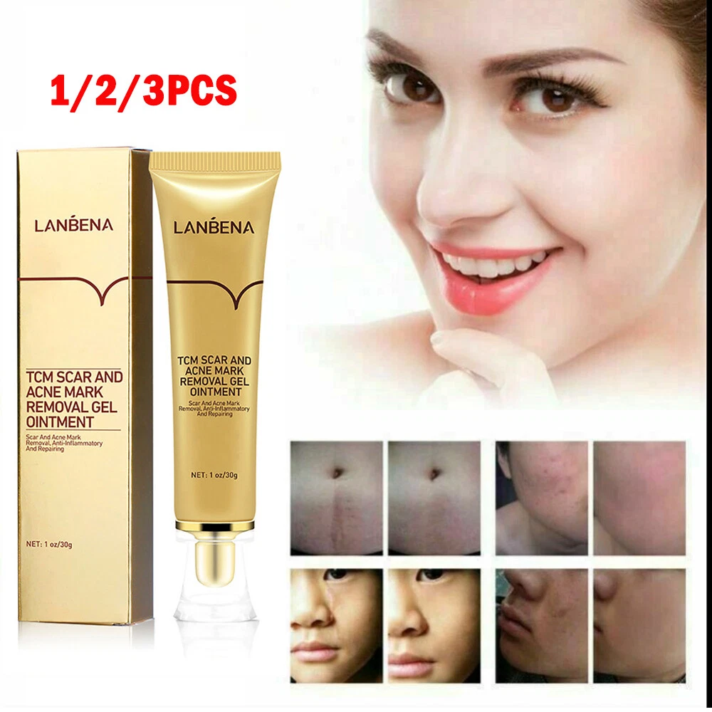 Acne cream scar removal deals