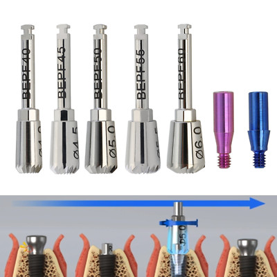 Implant Hiossen OSSTEM ET Bone Profilers 4.0 4.5 5.0 5.5 6.0 Guide Screws MIS