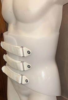 Boston Overlap Brace Molded Thermoplastic Adjustable 3 Strap LSO TLSO BOB Back