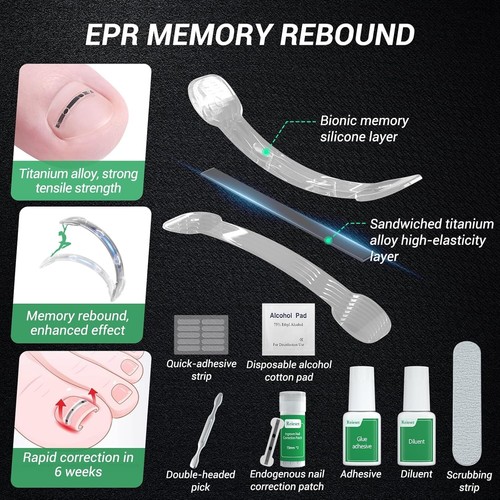 Rapid Ingrown Toenail Relief with Titanium Alloy Kit - Convenient & Effective - Picture 8 of 8