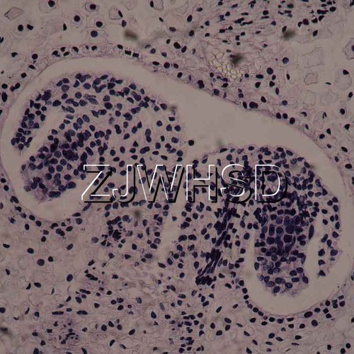 100pcs Glass Prepared Basic Science Microscope Slides Sample Biology Pathology - Picture 6 of 11