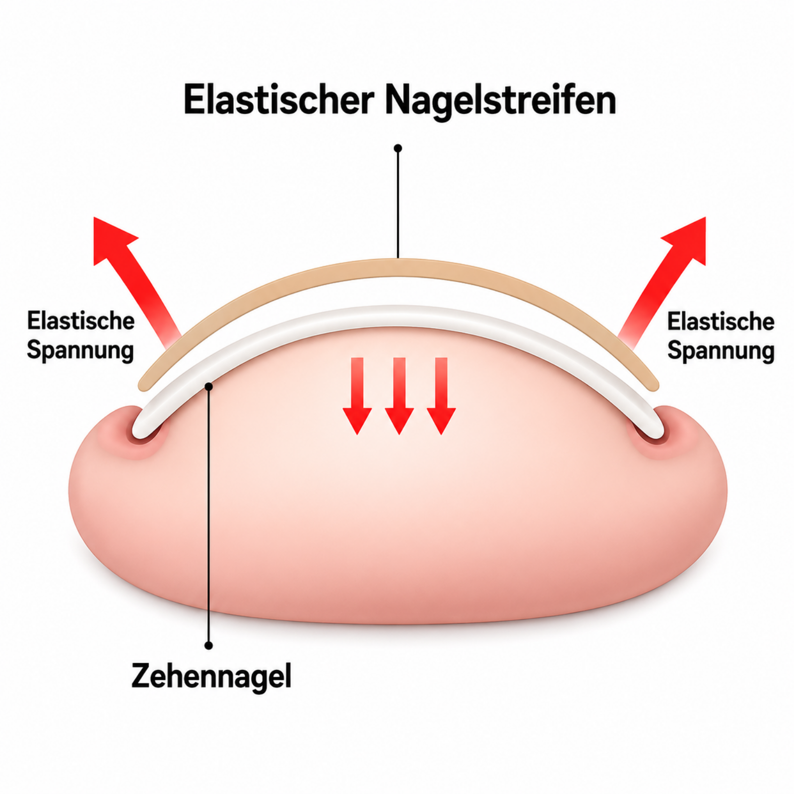 Zehennagel Korrekturstreifen Set Bild 4