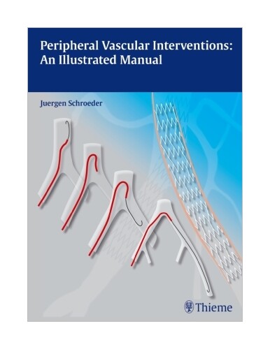 Thumbnail - Peripheral Vascular Interventions: An Illustrated Manual Von Jürgen