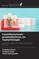Consideraciones ProstodóNticas En ImplantologíA Prajakta Ghule