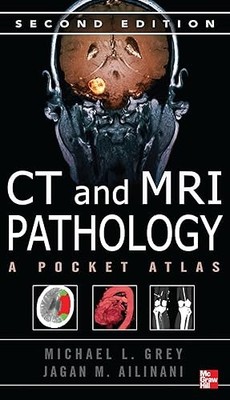 CT & MRI Pathology: A Pocket Atlas, Second Edition
