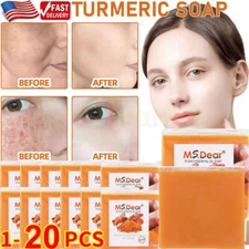 20X Tumeric Soap Skin Whitening Dark Spots lightening Acne Brightening Turmeric