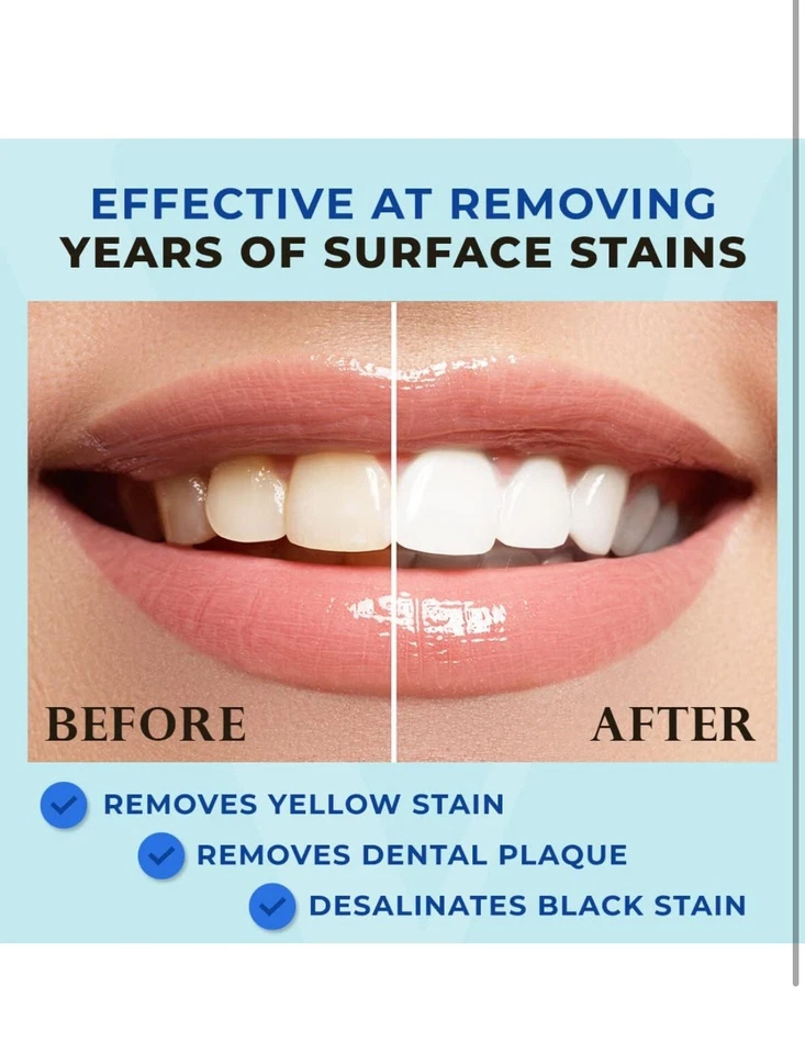 Venus Visage Award 获奖牙齿美白笔 2 笔 20 + 使用低灵敏度 — 第 2/4 张图片