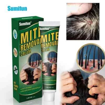 SUMIFUN New 30g Mite Removal Anti-Itching Cream Scabies Kill Head Lice Skin Care Natural