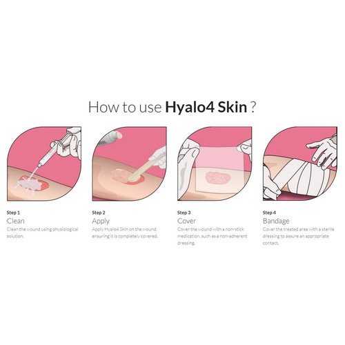 25g HYALO4 Skin Cream For Wounds, Ulcers, Sores, Irritation - Picture 4 of 4