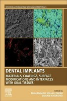 Dental Implants Muhammad Zafar (U. A.) Taschenbuch Einband - Fest (Hardcover)