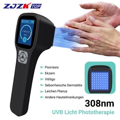 Portable 308nm Excimer UVB Light Therapy Device 5~50mW/cm² for Skin Conditions