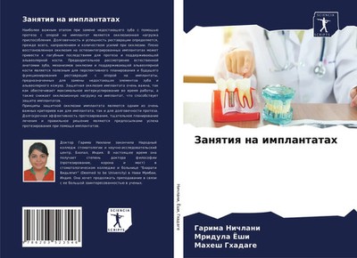 Garima Nichlani (u. a.) | Zanqtiq na implantatah | Taschenbuch | Russisch (2021)