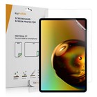 2 x protection d'écran pour film d'affichage HONOR Pad V8 Pro 