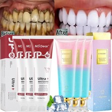 Niacinamide Whitening Toothpaste,Niacinamide Intensive Whitening Toothpaste 100g