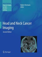 Robert Hermans | Head And Neck Cancer Imaging | Taschenbuch | Englisch (2016)