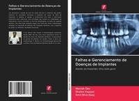 Falhas E Gerenciamento De DoençAs De Implantes Manish Dev
