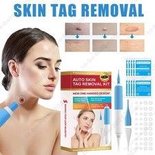 Painless Skin Tag Mole Wart Removal Kit Body Auto SKIN TAG Bands Remover Safe