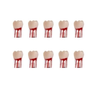 Dental Endo Root Canal Practice Teeth Model Pulp Study Practice Pulp Cavity #26